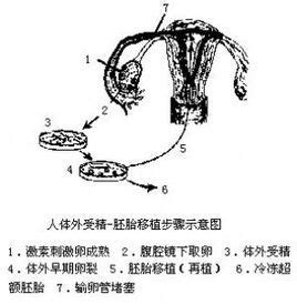 中国香港生殖医学服务有哪些? 体外受精图册_360百科